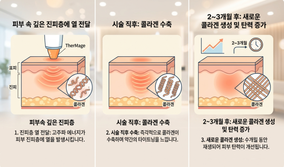 What Matters More Than Reviews or Events at a Thermage Dermatology Clinic Near Jamsil Station image 2