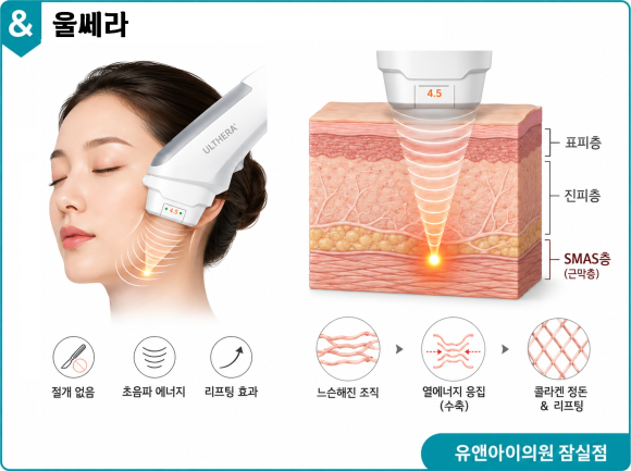 Songpa Ulthera vs. Ulthera PIFRAIME: Which One Is Better? image 3