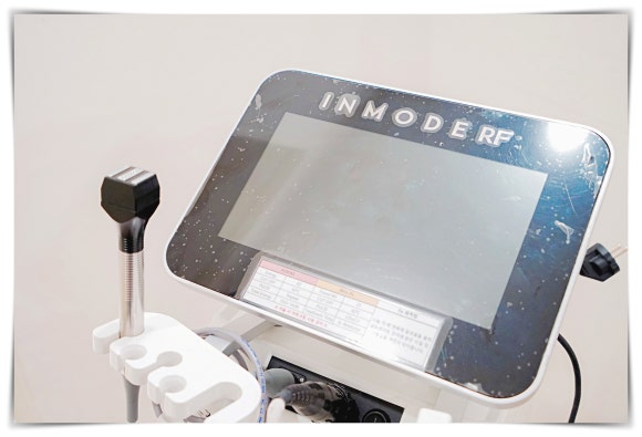 Jamsil InMode Lifting: How to See Results for Double Chin Fat and Buccal Fat image 3
