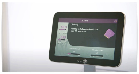 Thermage 900 Shots: Effect, Pain, and Side Effects — A Complete Summary image 4