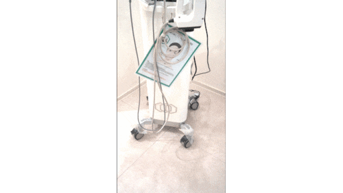 Jamsil InMode FX: Which Areas Is It Effective For, and How Painful Is It? image 9
