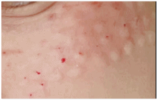 A Complete Guide to Care 3 Months, 1 Month, and 1 Week Before Important Events Near Jamsil Station image 8