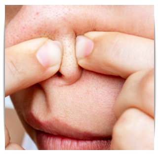 If you’re concerned about blackheads, sebum, pores, and dead skin, Jamsil Aqua Peel image 4