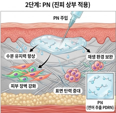 Seokchon Gobun Station Dermatology Clinic, Curious About the Combination of Rejuran and Juvelook? image 5
