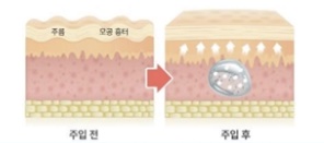 엘라비에 리투오 효과와 유지 기간은? 관련 이미지 6
