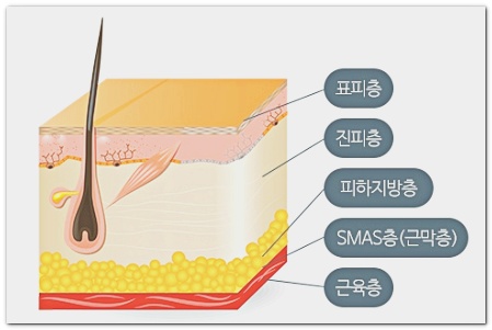 잠실올리지오 불독살 팔자주름 리프팅, 볼패임이 걱정이라면 관련 이미지 5