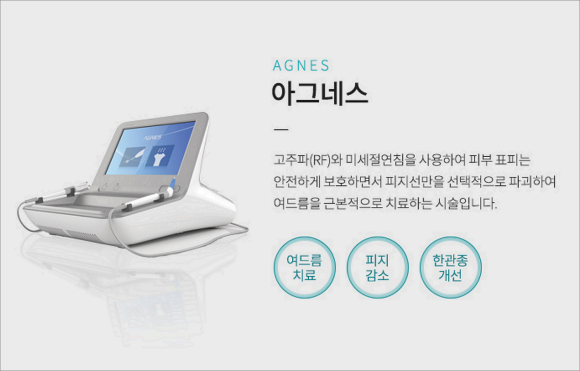석촌역여드름피부과 (진료과목: 피부과) 약 없이 반복되는 트러블 치료 후기 찾는다면 관련 이미지 4