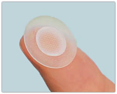 Jamsil Mole Removal CO2 Laser: How to Prevent Hyperpigmentation After Mole Removal image 5