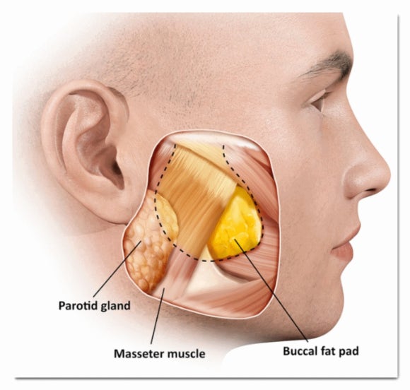 Songpa Ultherapy Lifting: Why the Procedure Is Performed While Viewing the Inside of the Skin image 5