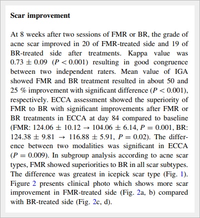 Jamsil Acne Scars: Can Depressed Marks Really Become Less Noticeable? image 7