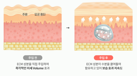 잠실리투오, 기존 스킨부스터와 무엇이 다를까? 원리부터 효과까지 관련 이미지 2