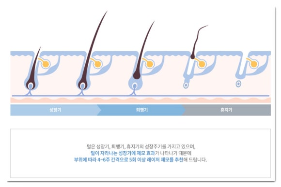 Jamsil Underarm Hair Removal: If Shaving Frequently Is a Hassle image 3