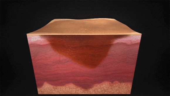 Jamsil Picosure Effects and Who It’s Recommended For (Including Tips to Lower the Cost) image 3