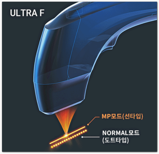 Seokchon Station Lifting: Is Shurink the Right Type for You? image 4