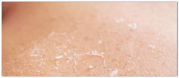 Men’s Skin Booster Injection: Is There a Reason to Get It Even If It’s Inconvenient? image 5