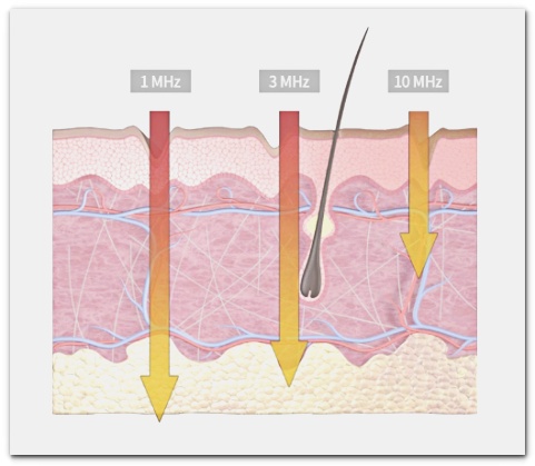 Jamsil LDM 6 Minutes, 12 Minutes, 24 Minutes: Differences in Moisturizing and Lifting Effects image 2