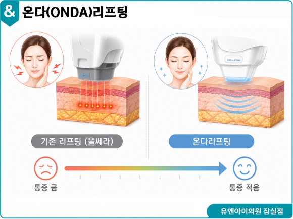 What Face Shapes See Results from Jamsil ONDA Lifting? Is It Painful, and Are There Any Side Effects? image 3