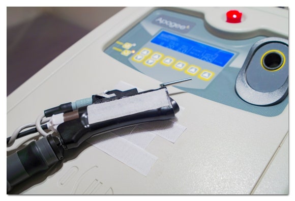 Jamsil Underarm Hair Removal: If Shaving Frequently Is a Hassle image 1