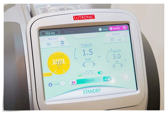 Can DermaV Laser Help Manage Redness and Melasma? image 2
