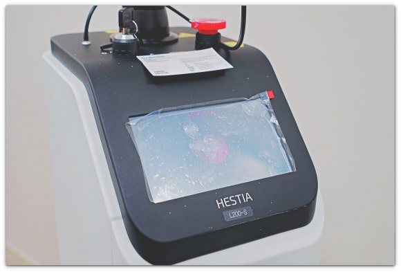 Jamsil Mole Removal CO2 Laser: How to Prevent Hyperpigmentation After Mole Removal image 9