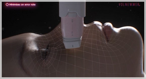 Jamsil Volnewmer Lifting Price, Effect, and How Long It Lasts image 7