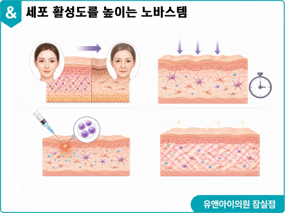 송파 피부과의원, 칙칙해진 피부엔 줄기세포주사 노바스템 추천 관련 이미지 4