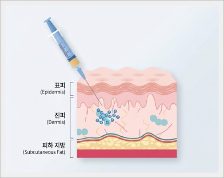 잠실 리투오 셀르디엠 기존 스킨부스터와 어떻게 다를까? 관련 이미지 7