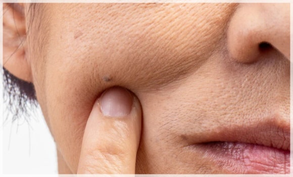 How Effective Is Liliid Skin Booster for Fine Wrinkles? image 1