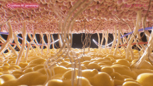 Volnewmer 600-Shot Effect: How Much Can It Cover? image 3