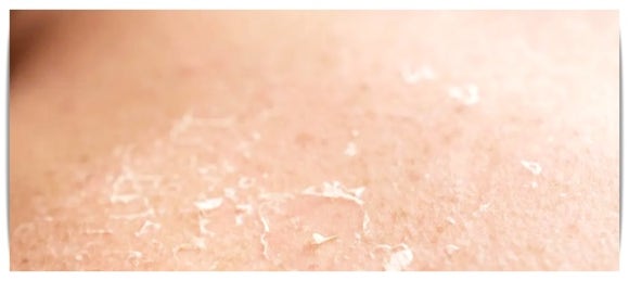 If you’re concerned about blackheads, sebum, pores, and dead skin, Jamsil Aqua Peel image 5
