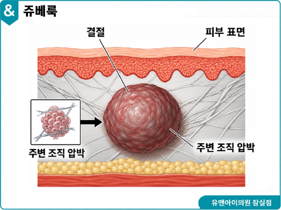 송파 피부과 추천, 넓어진 모공 푸석한 피부엔? 쥬베룩 스킨부스터 효과와 부작용 관련 이미지 4