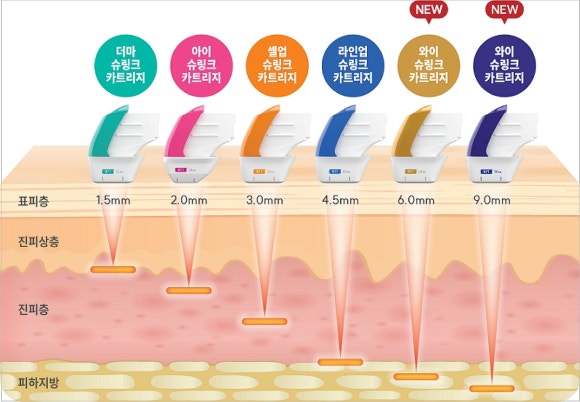 Jamsil Shurink, How Is It Different from Other Lifting Treatments? image 4
