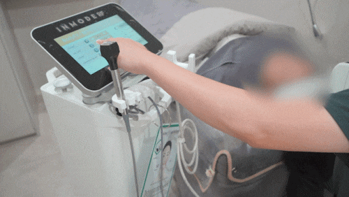Jamsil InMode FX: Which Areas Is It Effective For, and How Painful Is It? image 6