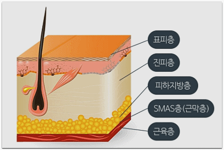 잠실여드름흉터 깊어도 치료 가능할까? 관련 이미지 2