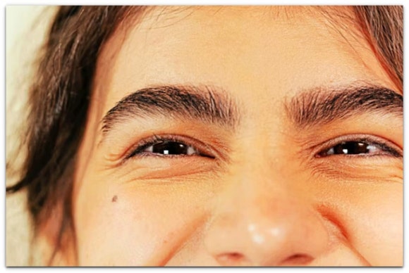 What Skin Types Is Jamsil Thermage Effective For? image 8