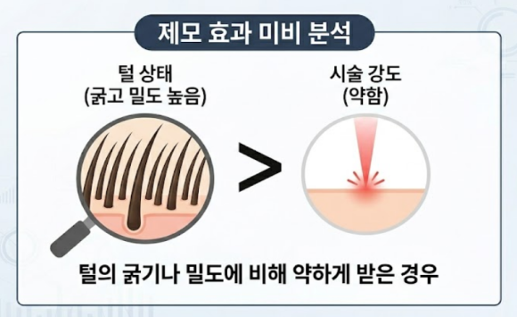 석촌역 피부과 제모 효과 제대로 받는 방법부터 주의사항까지 관련 이미지 5