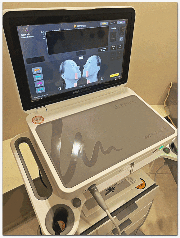 If You Were Afraid of the Pain and Couldn’t Get Ultherapy Near Seokchon Station, What Then? image 7