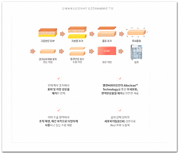 잠실리투오, 리쥬란과의 차이점? 뭘 받아야 할까? 관련 이미지 3