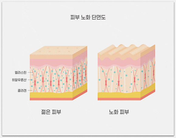 Seokchon Station Lifting: Is Shurink the Right Type for You? image 6