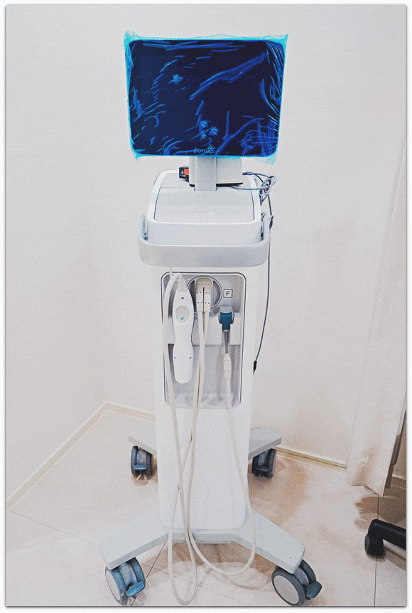 Songpa Lifting: Is There a Factor That Determines the Right Lifting Treatment for Me? image 3