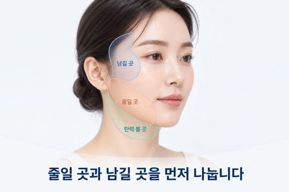 잠실 인모드, 얼굴살이 적으면 볼패임이 생길까? 관련 이미지 4