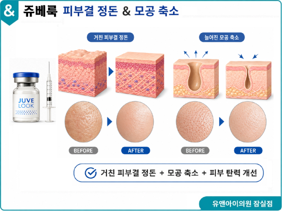 송파 피부과 추천, 넓어진 모공 푸석한 피부엔? 쥬베룩 스킨부스터 효과와 부작용 관련 이미지 3