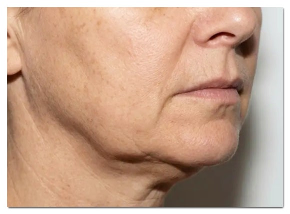 Munjung Station Dermatology: Don’t Just Get Any Procedure—Have the Cause Diagnosed First image 4