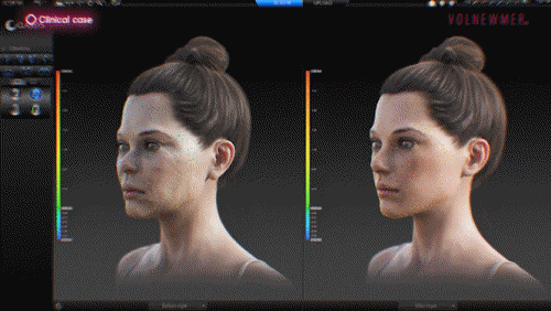 Volnewmer 600-Shot Effect: How Much Can It Cover? image 7