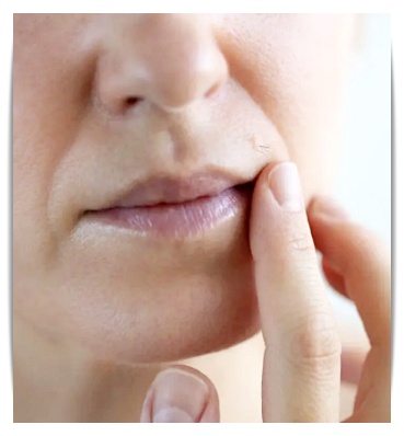 Thermage 900 Shots: Effect, Pain, and Side Effects — A Complete Summary image 2