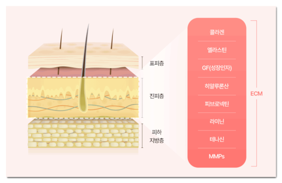잠실 리투오 셀르디엠, 같은 ECM 스킨부스터라도 다른 이유 관련 이미지 4