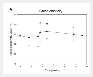 Belotero Revive Effects: Honestly, What Are They? image 5