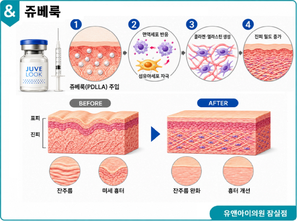송파 피부과 추천, 넓어진 모공 푸석한 피부엔? 쥬베룩 스킨부스터 효과와 부작용 관련 이미지 2