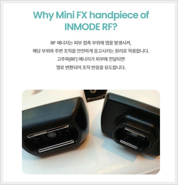 인모드 fx 심부볼 제거 효과는? 관련 이미지 2