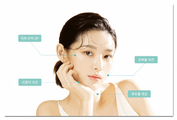 잠실온다리프팅 10만줄 통증 걱정된다면 관련 이미지 8
